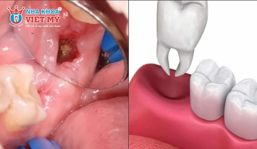 Dấu hiệu nhận biết lành thương bình thường và bất thường