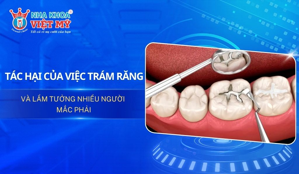 Tác hại của việc trám răng
