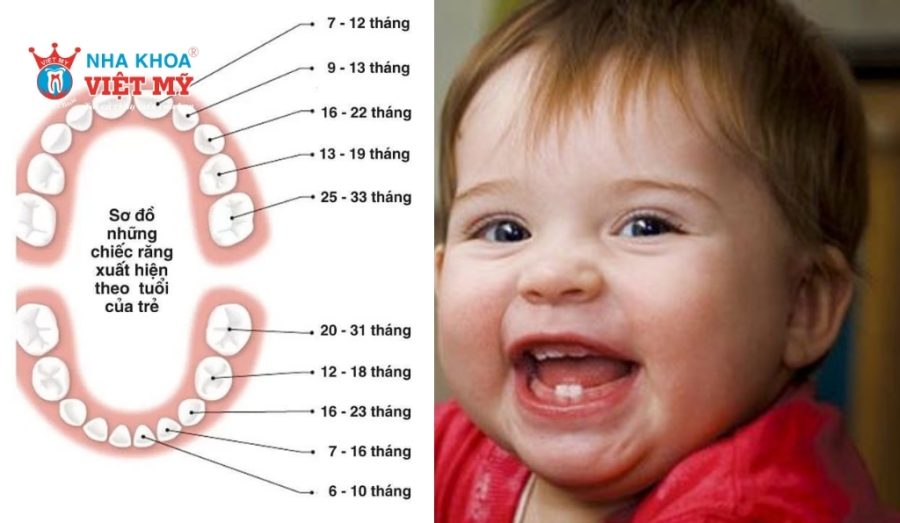 Quá trình mọc răng sữa của trẻ em