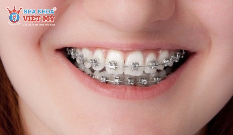 Một số câu hỏi thường gặp