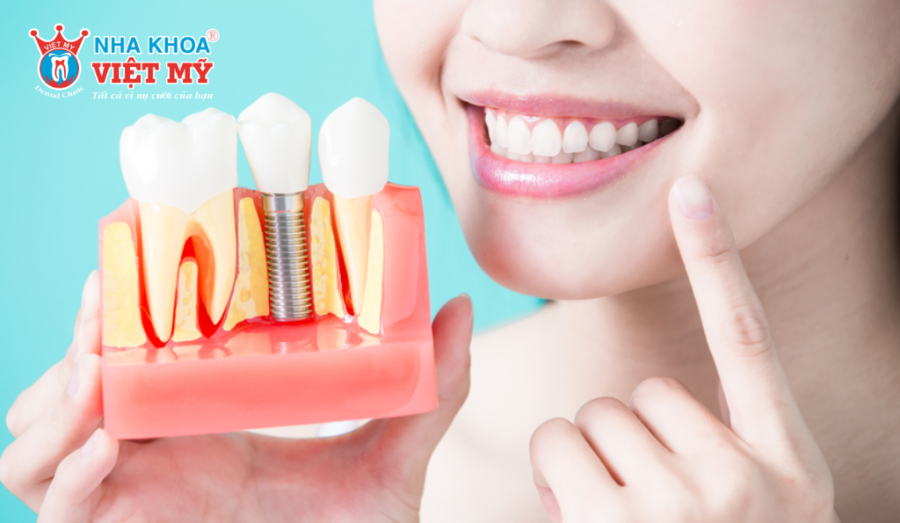 Abutment and Crown Placement: The final steps for a seamless, natural-looking tooth replacement.