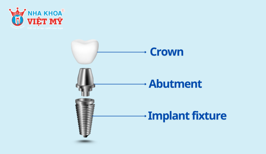 The three main components of a dental implant: the implant fixture, abutment, and crown