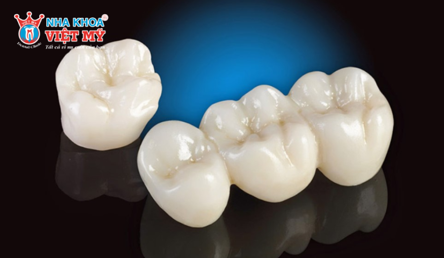 Tuổi thọ răng sứ phụ thuộc loại sứ, tay nghề bác sĩ và cách chăm sóc