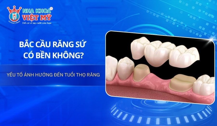 Bắc cầu răng sứ có bền không? Yếu tố ảnh hưởng đến tuổi thọ răng