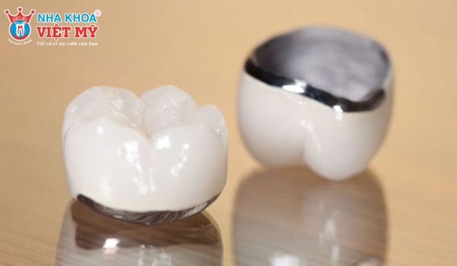 Câu hỏi thường gặp về bọc răng sứ 1 chiếc