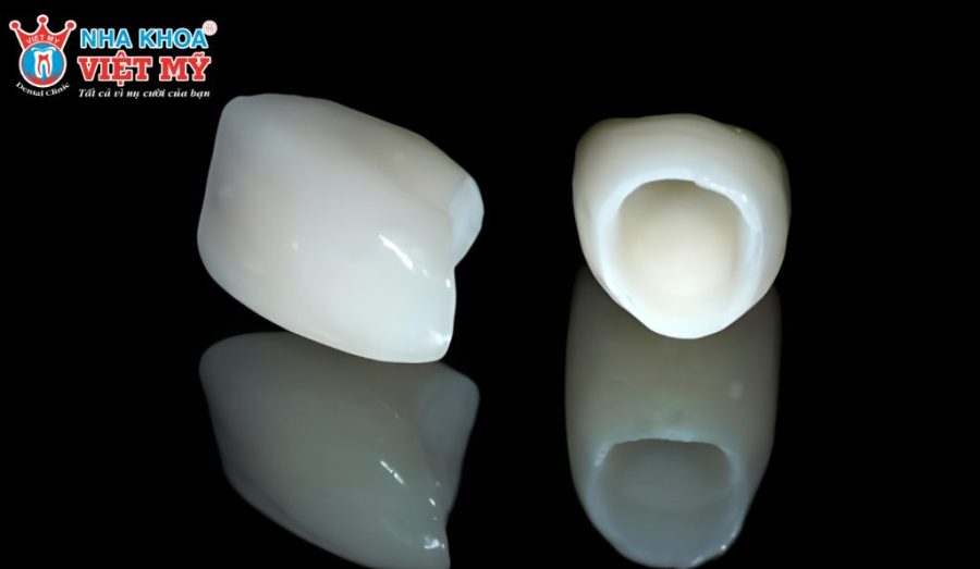 Ưu điểm khi bọc răng sứ 1 chiếc