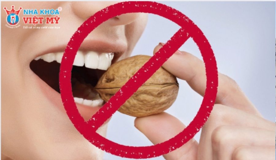 Hạn chế ăn đồ quá cứng để bảo vệ mão sứ