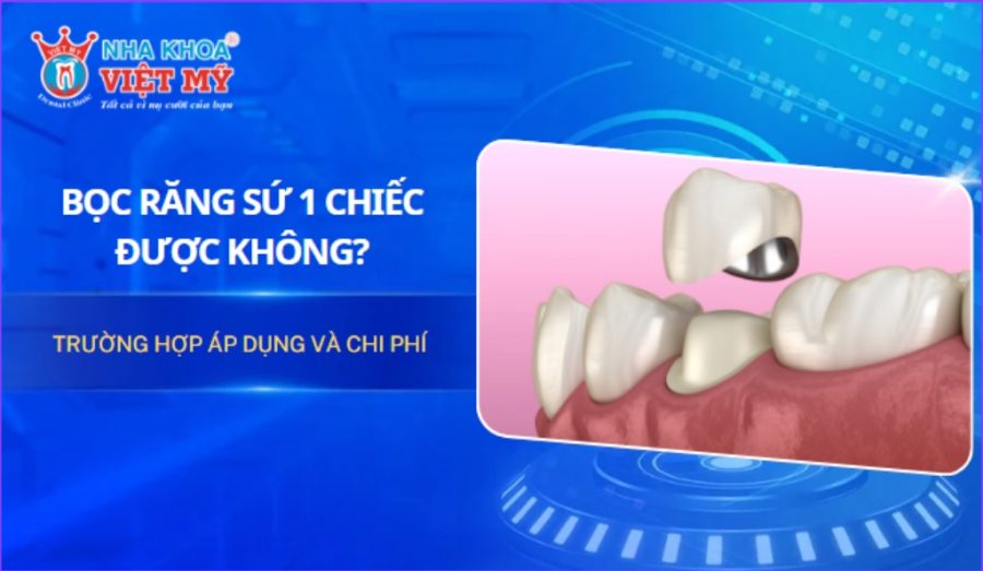 Bọc răng sứ 1 chiếc được không? Trường hợp áp dụng và chi phí