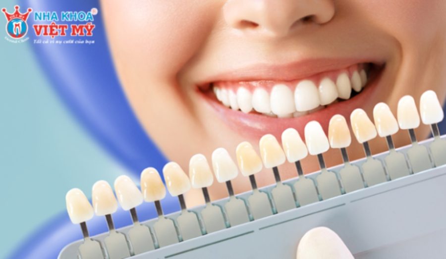 Khác biệt về màu sắc do sứ không đạt chất lượng