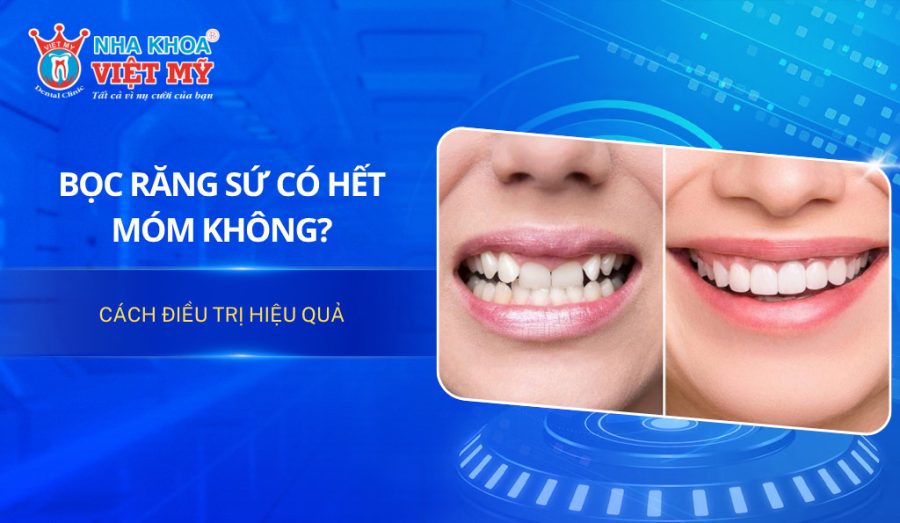 Bọc răng sứ có hết móm không? Cách điều trị hiệu quả