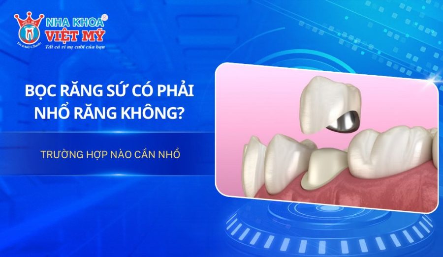 Bọc răng sứ có phải nhổ răng không? Trường hợp nào cần nhổ