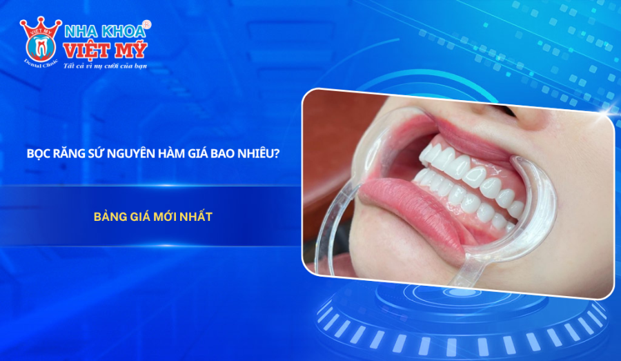Bọc răng sứ nguyên hàm giá bao nhiêu? Bảng giá mới nhất