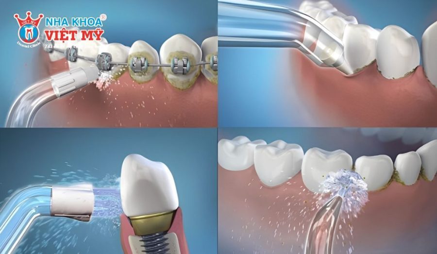 Công dụng của máy tăm nước