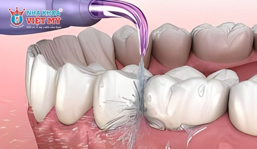 Hướng dẫn cách sử dụng máy tăm nước hiệu quả