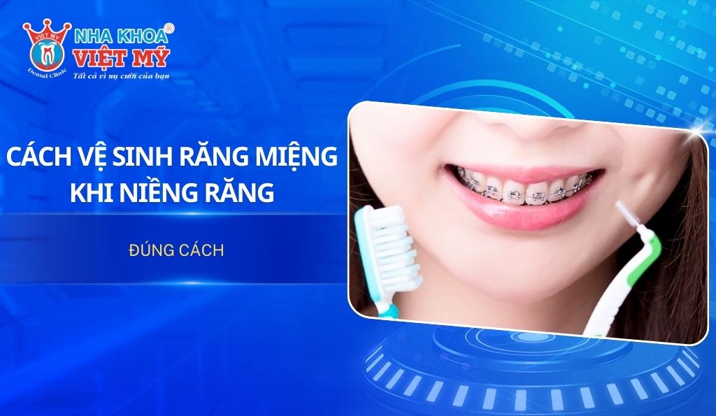 Cách vệ sinh răng miệng khi niềng răng đúng cách