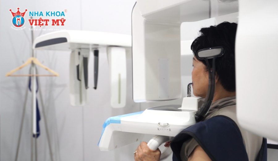 Chụp CT Cone Beam 3D để đánh giá chất lượng xương hàm và vị trí cấy ghép phù hợp