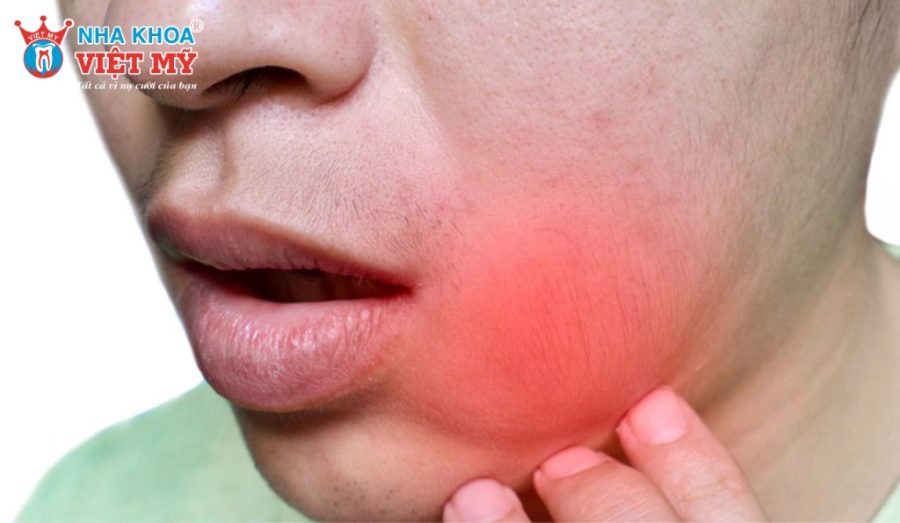 Tại sao bị nhiễm trùng sau khi nhổ răng