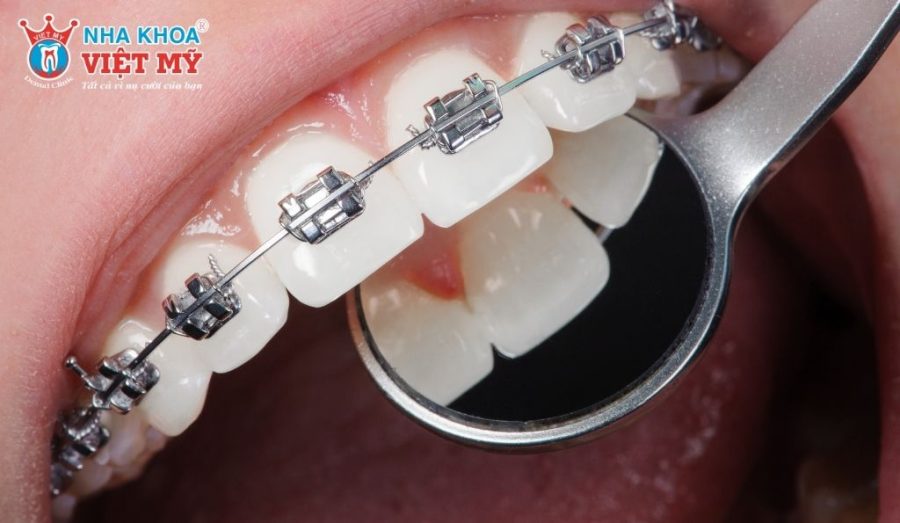 What are some common dental procedures for travelers?