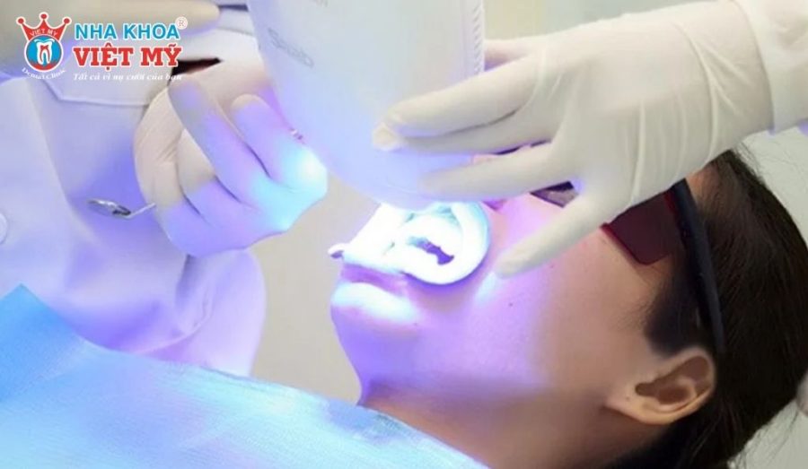 Điểm danh các phương pháp tẩy trắng răng phổ biến nhất hiện nay