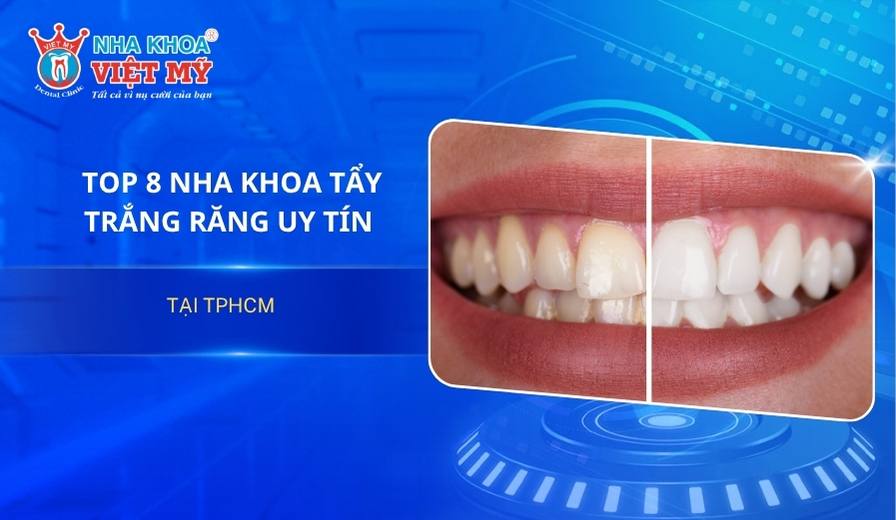 Địa chỉ làm trắng răng uy tín TPHCM
