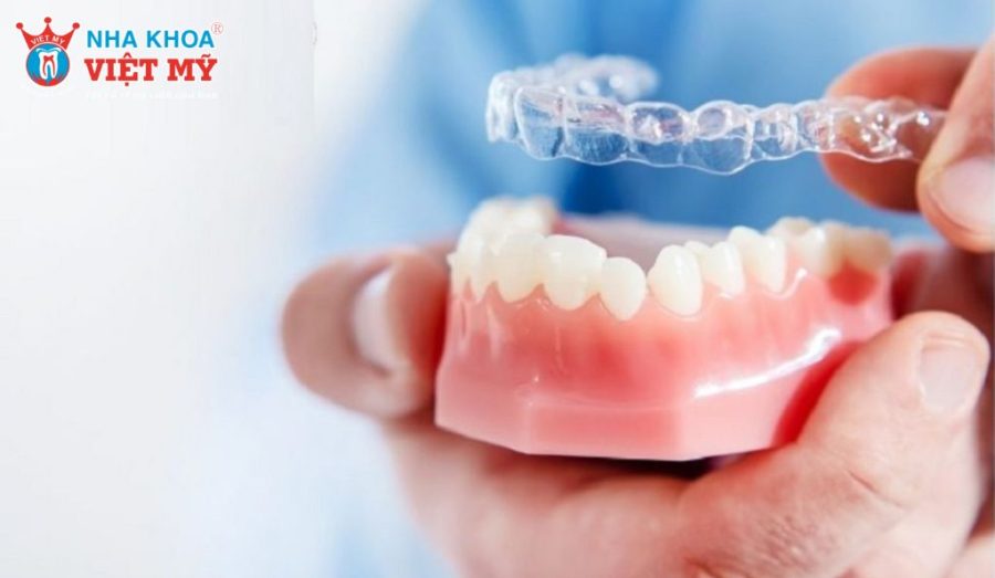 Chi phí của hàm duy trì trong suốt là bao nhiêu?