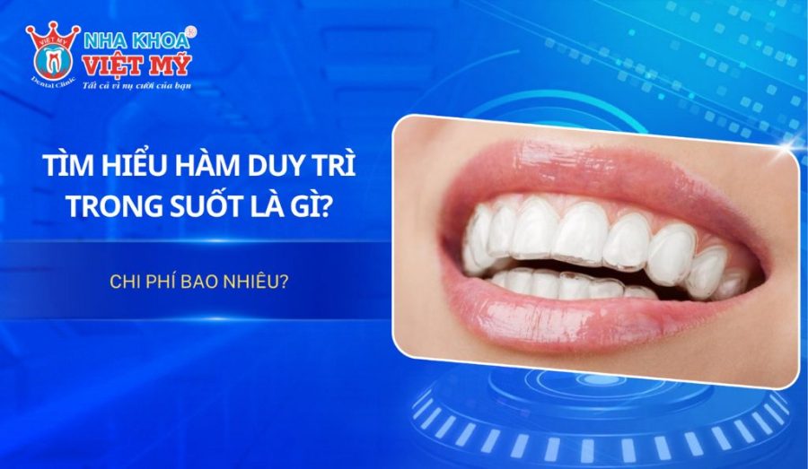 Hàm duy trì trong suốt là gì? Chi phí bao nhiêu?