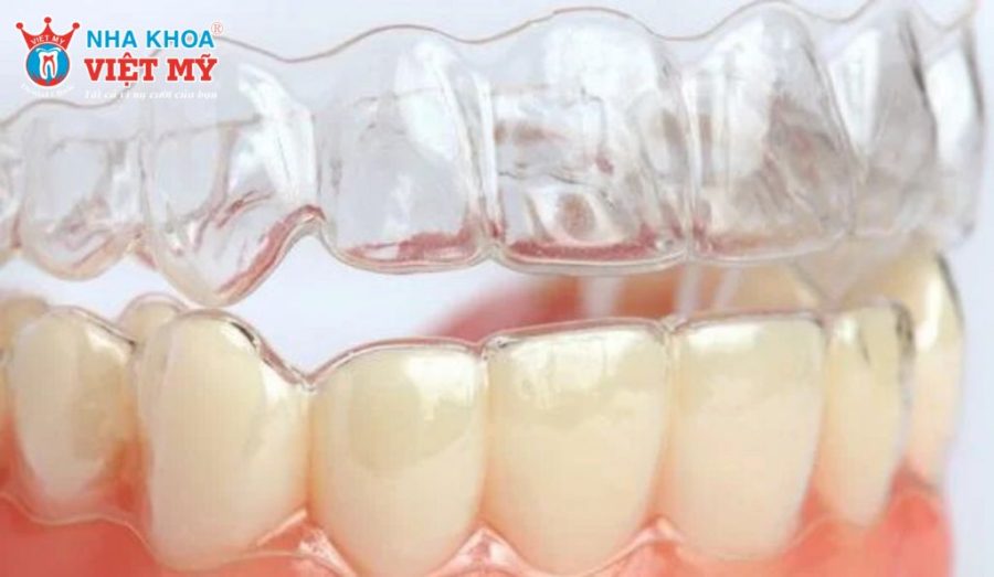 Hàm duy trì trong suốt là gì? 