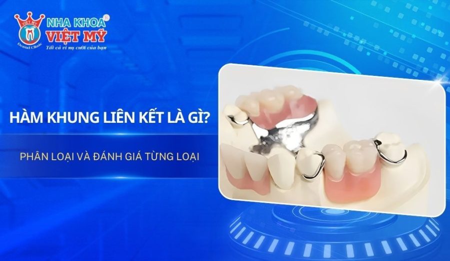 Hàm khung liên kết là gì? Phân loại và đánh giá từng loại