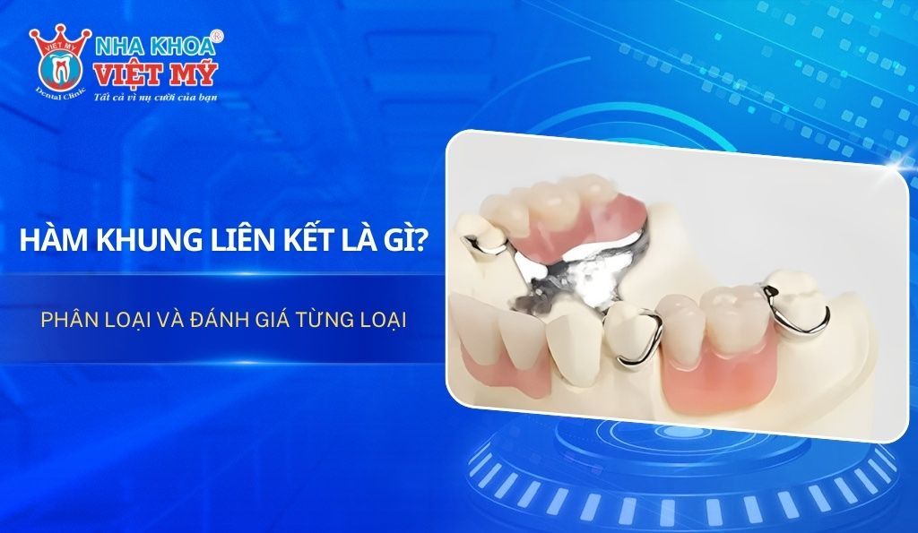 Hàm khung liên kết là gì? Phân loại và đánh giá từng loại