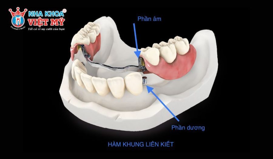 Hàm khung liên kết Attachment