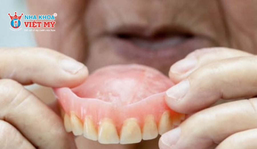 Hàm khung tháo lắp giúp khắc phục tình trạng mất một hoặc nhiều răng