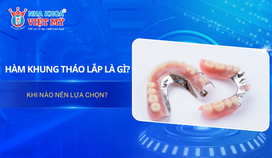 Hàm khung tháo lắp là gì? Khi nào nên lựa chọn