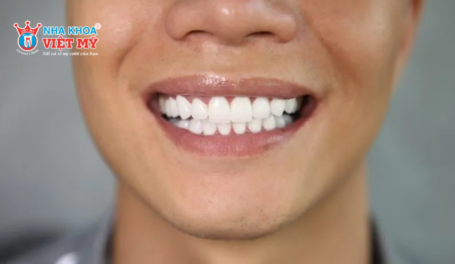 Hàm khung tháo lắp phục hình răng mất trong thời gian ngắn