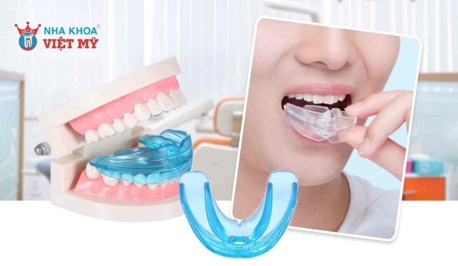 Giá của hàm silicon Trainer phụ thuộc vào nhiều yếu tố