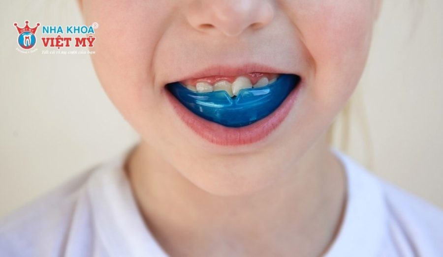 Hàm Trainer giúp răng trẻ không bị mọc sai lệch khớp cắn