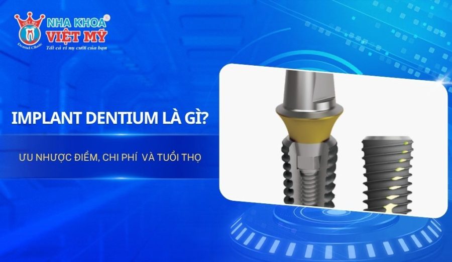 Implant Dentium là gì? Ưu nhược điểm, chi phí và tuổi thọ