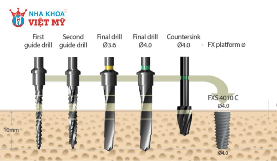 Trụ Dentium Hàn Quốc có nhiều mức giá khác nhau theo từng phân loại 