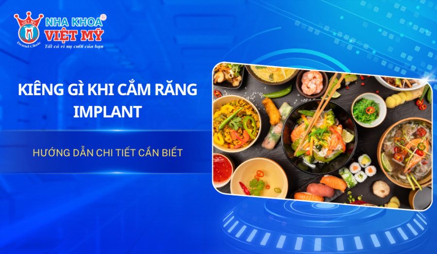 Kiêng gì khi cắm răng Implant? Hướng dẫn chi tiết cần biết