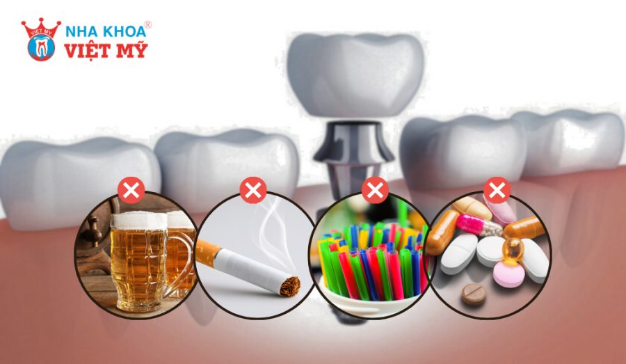 Cần kiêng gì khi cắm răng Implant để răng chắc khỏe