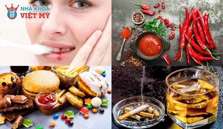 Nguyên nhân gây các bệnh nguy hiểm về răng miệng xuất phát từ nhiều yếu tố 