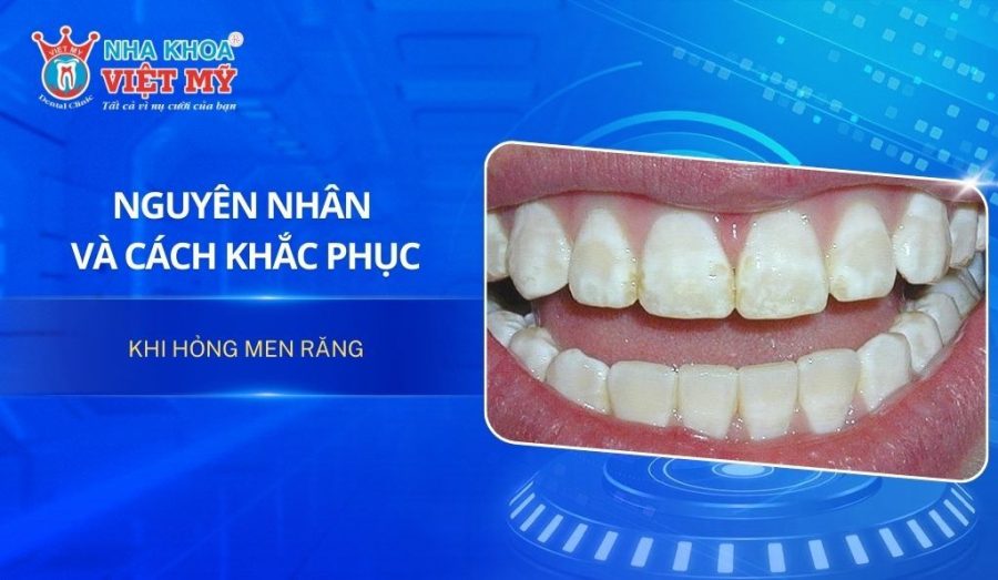 Nguyên nhân và cách khắc phục khi hỏng men răng