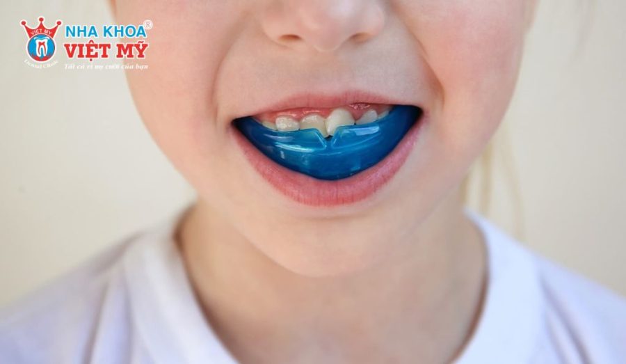 Niềng răng silicon cho trẻ