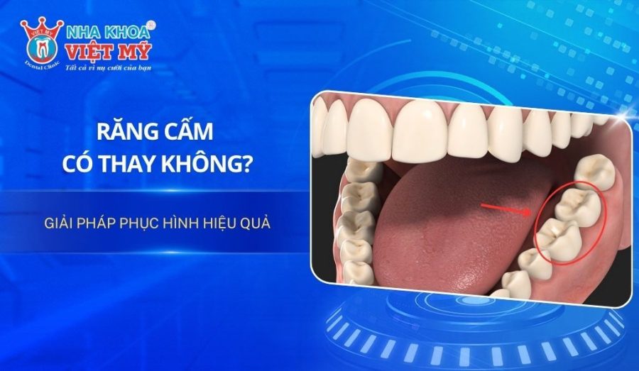 Răng cấm có thay không? Giải pháp phục hình hiệu quả
