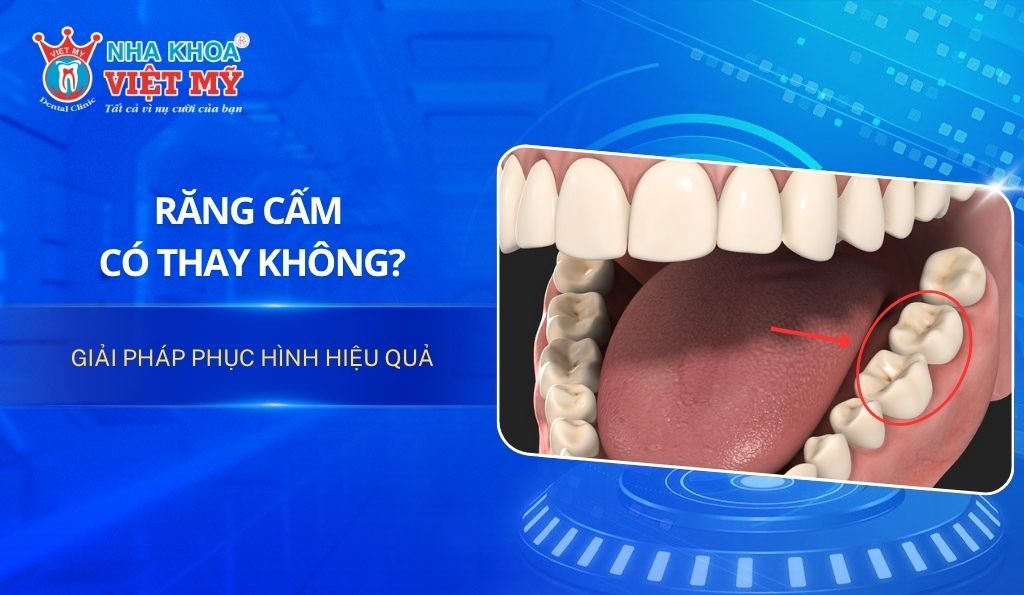 Răng cấm có thay không? Giải pháp phục hình hiệu quả