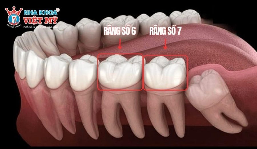 Răng cấm là răng số 6 và 7 trong nhóm răng hàm
