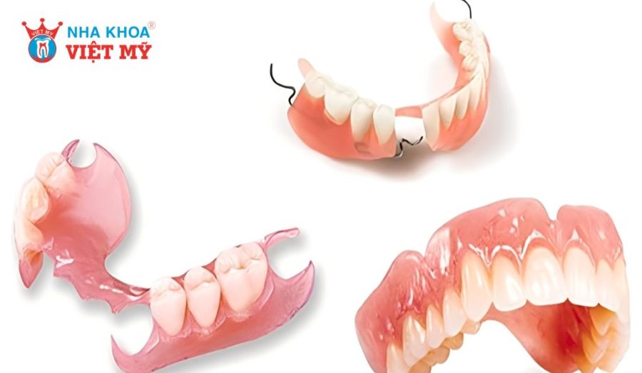 Chi phí làm răng giả tháo lắp hiện nay