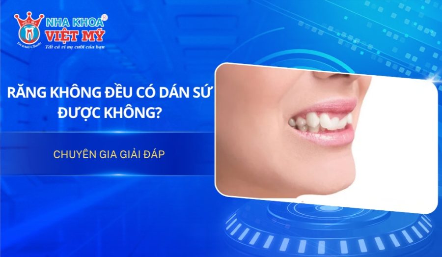 Răng không đều có dán sứ được không?