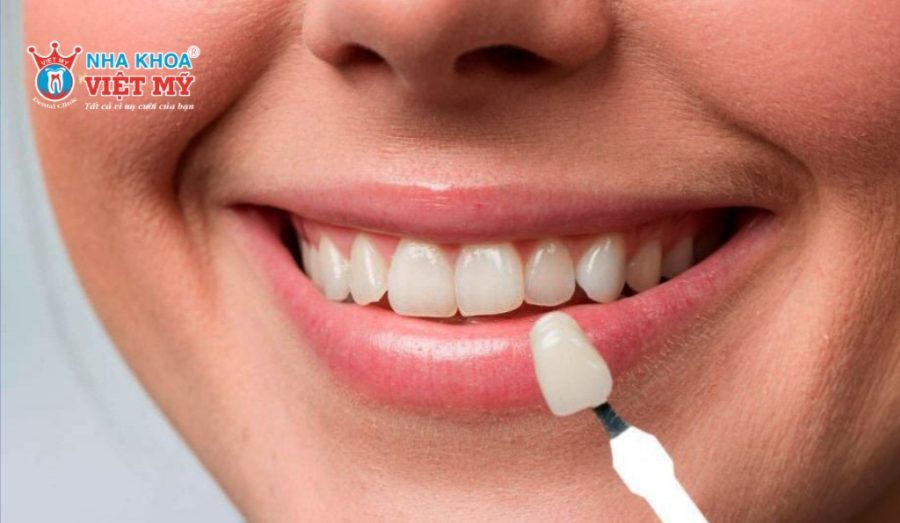 Dán sứ Veneer vừa đảm bảo tính thẩm mỹ vừa giữ được cảm giác tự nhiên khi ăn nhai