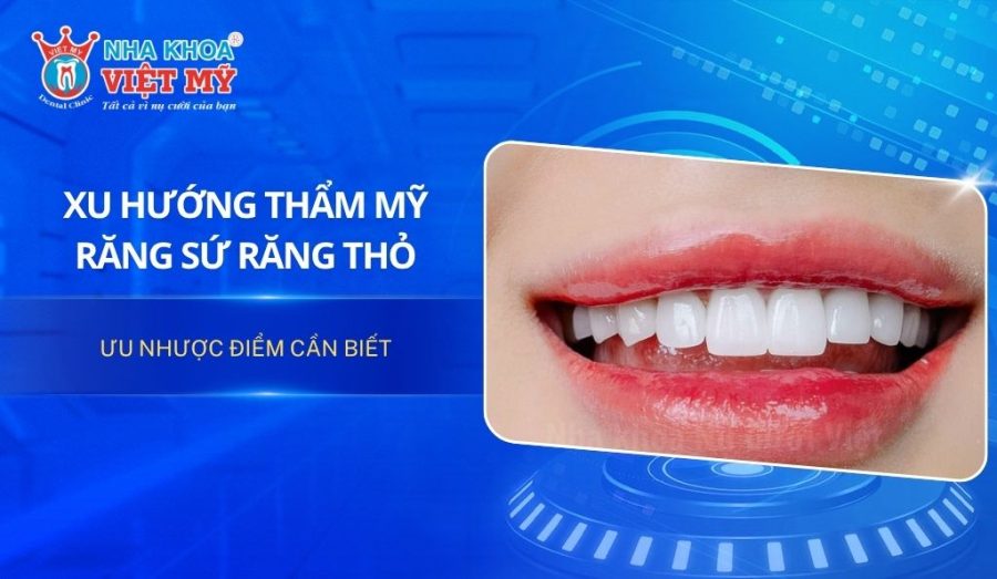 Răng sứ răng thỏ: Xu hướng thẩm mỹ, ưu nhược điểm cần biết
