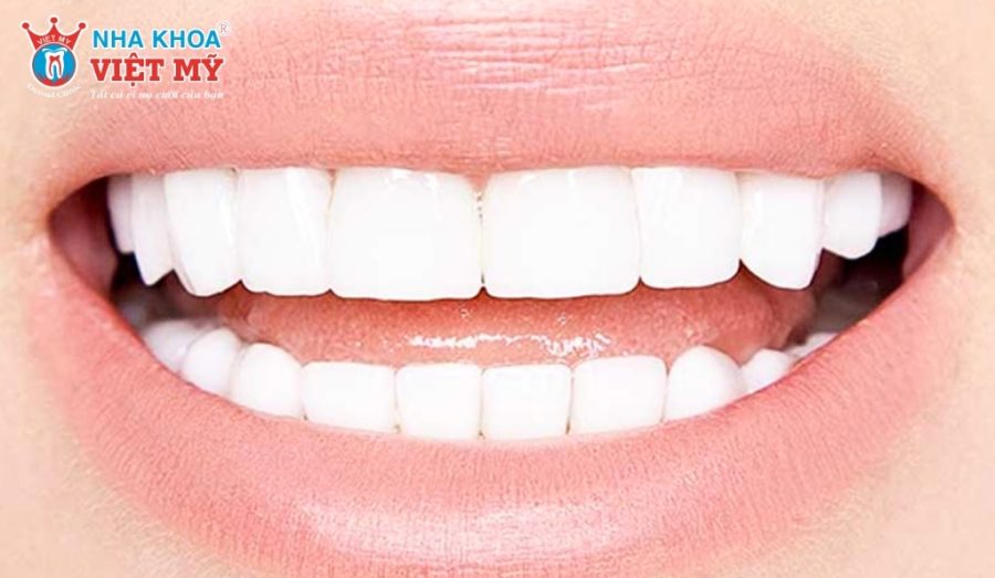 Sứ có màu trắng đục quá mức có thể bắt buộc phải thay mới